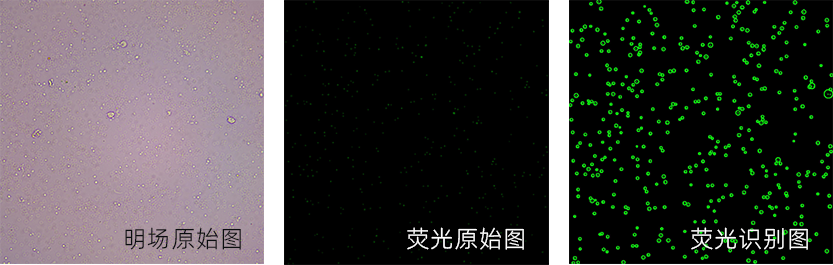 圖像法自動化的血小板計數